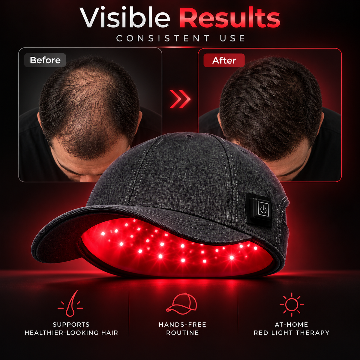 RootNova™Hair Growth Cap Set